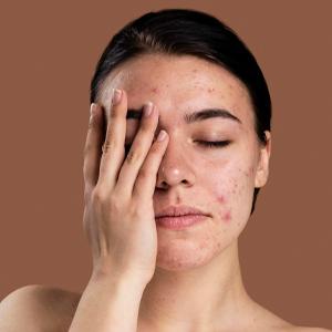 Skin Treatments